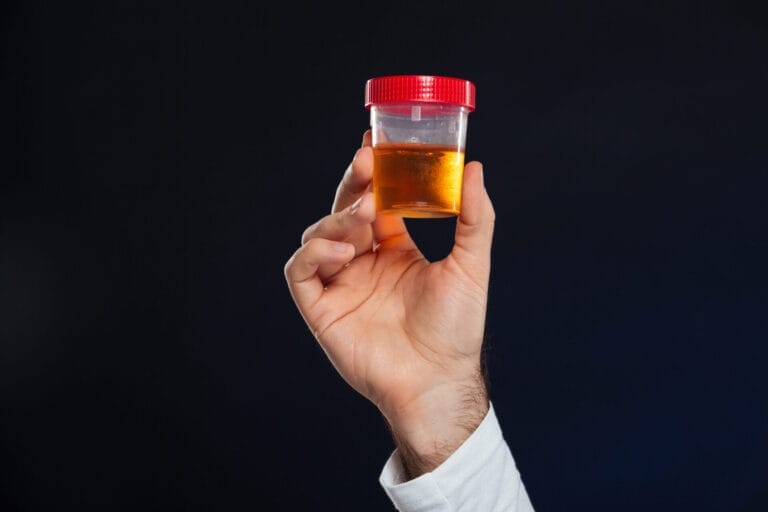 kenapa urine berwarna merah