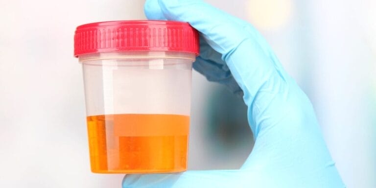 hematuria