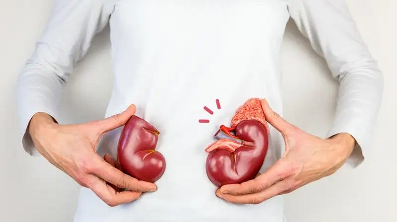 Seseorang memegang model ginjal di pinggangnya, dengan model yang tepat juga menunjukkan kelenjar adrenal dan ureter, yang menggambarkan anatomi ginjal serta pentingnya kebiasaan sehari hari dalam menjaga ginjal dan kesehatan ginjal.