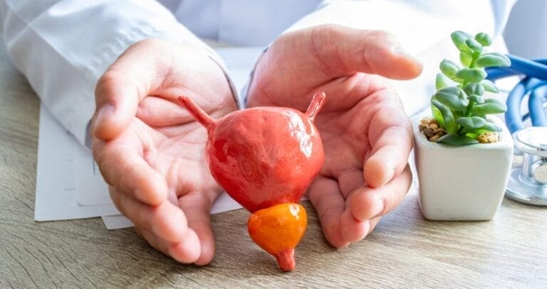 Seseorang dengan jas putih memegang model sistem saluran kemih pria, menyoroti kandung kemih dan prostat sempurna untuk membahas kanker prostat atau makanan penyebab kanker prostat di atas meja di samping pot tanaman kecil.