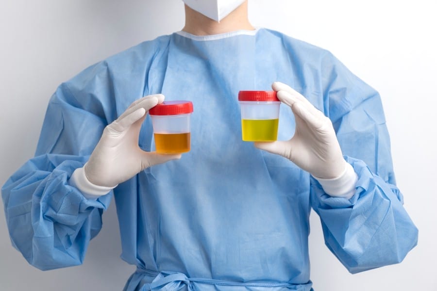 Seseorang yang mengenakan scrub dan sarung tangan medis memegang dua wadah sampel urin, yang menunjukkan perbedaan warna urin satu urin berwarna kuning tua dan satu urin berwarna kuning muda dengan latar belakang polos, untuk mengilustrasikan ciri ciri urin yang normal.