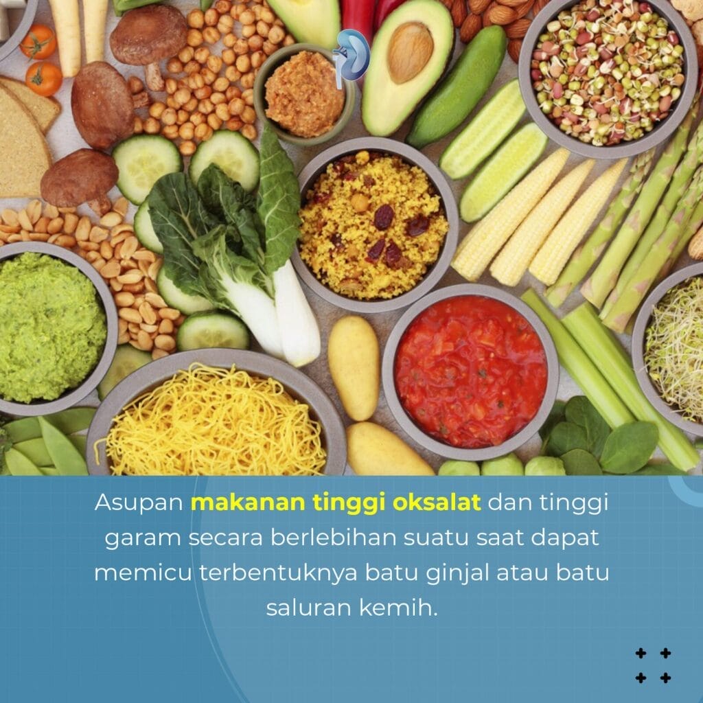 Berbagai makanan tinggi oksalat, termasuk kacang kacangan, biji bijian, sayuran hijau, dan sayuran, disusun dalam mangkuk dan di atas meja dengan teks informasi Konsep Otomatis dalam bahasa Indonesia di bawahnya.